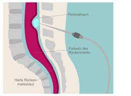 Public displays of affection, can be seen in the form of kissing, touching, groping, licking, nuzzling, cuddling, crossing hands into each other's opposite back pockets, etc. Die Periduralanasthesie Pda Informationen