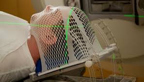 Cancer of oral cavity 2. What You Need To Know About Radiation Masks Moffitt
