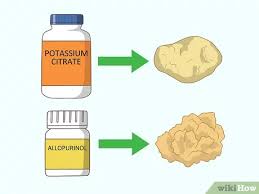 Kidney stones are surprisingly common. 3 Ways To Pass A Kidney Stone Wikihow