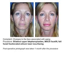 Facelift Surgery » UF Health Plastic Surgery and Aesthetics Center » UF  Academic Health Center » University of Florida