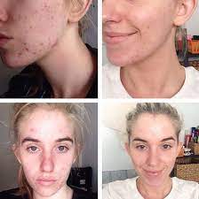 Read why you should do *it* longer. Best Frank Body Coffee Scrub Before And After Photos Video Frank Body Coffee Scrub Frank Body Coffee Body Scrub