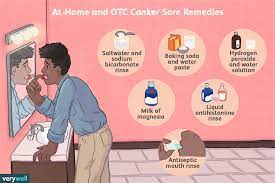 How To Get Rid Of Canker Sores: Salt, Baking Soda, & More