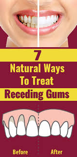 At first glance, this can make your snack options seem rather limited — after all, many premade snacks are brimming wit. How To Keep Gums Healthy 7 Ways Receding Gums Teeth Health Gum Health