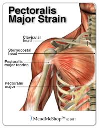 It consists of a clavicular part and a sternal part, both converging to a flat tendon that inserts on the humerus. Pec Major Tendon Strain