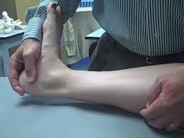 Homan S Test For Dvt Cu Youtube