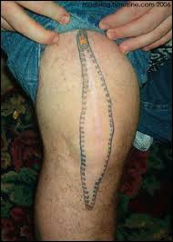 Join imgur emerald to award accolades! Zipper Search Results Bme Tattoo Piercing And Body Modification News Page 2