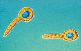 It helps you quickly find and retrieve specific information. Clostridium Tetani Antigens Creative Diagnostics