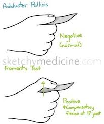Hand Exam Motor 13 13 Adductor Pollicis Hand Therapy Occupational Therapy Ulnar Nerve