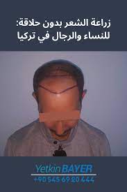 زراعة الشعر بدون حلاقة للنساء والرجال في تركيا