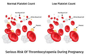 I think it may inhibit platelet aggregation though, but thats not the same thing as count. What Causes Low Platelet Count In Adults Quora
