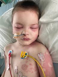 Shocking pics of boy, 6, fighting for life in hospital with rare disease  linked to Covid