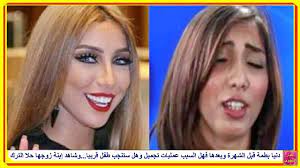 وعلى الرغم من حالة الجدل التي تحدثها الفنانة المغربية بتغير ملامحها، إلا أن دنيا بطمة كانت قد أنكرت النجمة المغربية أنها خضعت لأي عملية تجميل من قبل إلا أن الجمهور قد لاحظ التغير الكبير في ملامحها أكثر من مرة هو شكك في. Ø¯Ù†ÙŠØ§ Ø¨Ø·Ù…Ø© Ù‚Ø¨Ù„ Ø§Ù„Ø´Ù‡Ø±Ø© ÙˆØ¨Ø¹Ø¯Ù‡Ø§ ÙÙ‡Ù„ Ø§Ù„Ø³Ø¨Ø¨ Ø¹Ù…Ù„ÙŠØ§Øª ØªØ¬Ù…ÙŠÙ„ ÙˆÙ‡Ù„ Ø³ØªÙ†Ø¬Ø¨ Ø·ÙÙ„ Ù‚Ø±ÙŠØ¨Ø§ ÙˆØ´Ø§Ù‡Ø¯ Ø¥Ø¨Ù†Ø© Ø²ÙˆØ¬Ù‡Ø§ Ø­Ù„Ø§ Ø§Ù„ØªØ±Ùƒ Youtube