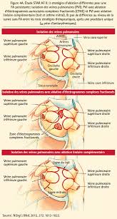 Une exposition prolongée aux rayonnements pendant la procédure met le patient et l'opérateur à. Ablation In Persistent Af State Of The Art Journal De Cardiologie