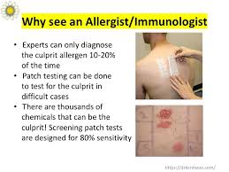 Image result for Patch Testing