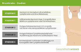 Brustkrebs Ursachen Behandlung Vorbeugung