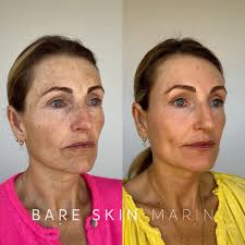 Bare Skin Marin (@bareskinmarin) · Kentfield, CA