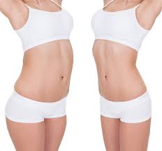 Liposuction Vs Tummy Tuck Liposuction Tummy Tucks Tummy Tuck Cost