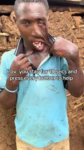 Ronald Mountain Accident