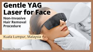 With that in mind, we evaluated laser hair removal places near you based on their laser hair removal prices and client reviews —focusing on what their clients say about their experience as well as their results— to put together a list of the best places to get laser hair removal in st. Gentle Yag Laser For Face Non Invasive Hair Removal Procedure Trambellir