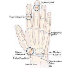Meist nur ein kosmetisches problem. Pin Auf Gesundheit