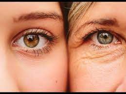 15 Gun De Goz Cevresi Kirisiklari Ile Kaz Ayaklarina Yontem Guzellik Bakim Youtube Anti Aging Krem Dogal Cilt Bakimi Dogal Cilt