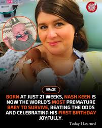 Born at 21 Weeks, Baby Nash Defies Science and Becomes a Guinness World  Record Holder They call him “Nash Potato,” but this tiny warrior from Iowa  is anything but small when it
