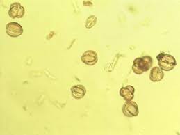 Image result for Sclerocroton