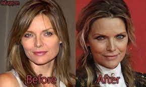 Michelle has never officially admitted to having plastic surgery, but in a 2012 interview with cnn's dr. 20 Plastische Op Ideen Prominente Plastische Chirurgie Plastische Chirurgie Schonheit