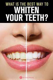 What Is The Best Way To Whiten Your Teeth Oral Care Oral Health Activities Best Oral