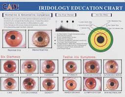 Exact Sclerology Chart Emotional Iridology Chart Iridology