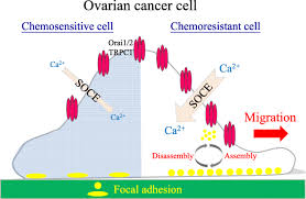 Ovarian cancer is highly curable if it's diagnosed and treated early, but the symptoms can be easy to miss. Chemoresistant Ovarian Cancer Enhances Its Migration Abilities By Increasing Store Operated Ca 2 Entry Mediated Turnover Of Focal Adhesions Journal Of Biomedical Science Full Text