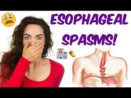 Spasms And Nutcracker Esophagus Is Your Esophagus Going Nuts Youtube Nutcracker Esophagus Medical Conditions Esophageal Spasm