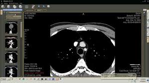 It fully supports the dicom standard for an easy integration in your workflow environment and an open platform. Know Important Things About The Free Web Based Dicom Viewer Free Web Web Based Movie Posters