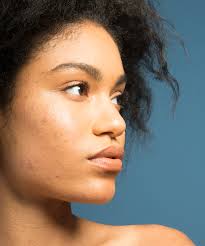 black skin care dermatologist red flags