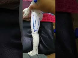 Ia merupakan satu masalah yang menyebabkan penderita itu tidak mampu pergi ke tandas untuk membuang air kecil. Point Urut Kencing Tak Lawas 011 50404441 Youtube