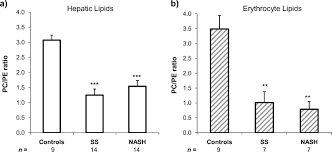 14.09.2021 · a low p/e ratio of stocks suggests a value orientation. Nonalcoholic Fatty Liver Disease Is Associated With Lower Hepatic And Erythrocyte Ratios Of Phosphatidylcholine To Phosphatidylethanolamine