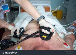 Image result for Synchronized Cardioversion