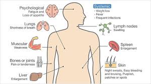 In severe cases, bleeding in the stomach or duodenum. What Are Some Of The Common Symptoms Of Leukemia Everyday Health