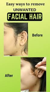 Therefore, with regular use of a turmeric hair removal mask, you can say goodbye to unwanted facial hair. Natural Way To Remove Your Unwanted Facial Hair Facialhair Unwantedfacialhair Beauty Unwanted Facial Hair Remove Unwanted Facial Hair Underarm Hair Removal