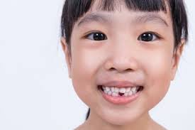 How to pull out a tooth without pain. Pin On Good To Know
