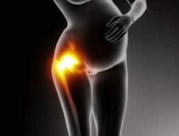 Hip Pain During Pregnancy Causes Treatment Phyx Physio Pilates