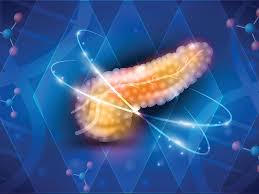 Symptoms can include feeling thirsty and hungry, and having to urinate often. Bluestar Genomics Gets Breakthrough Nod For Pancreatic Cancer Screening Test 2021 04 01 Bioworld