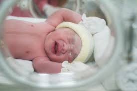 Check spelling or type a new query. Kondisi Yang Memerlukan Resusitasi Bayi Baru Lahir Alodokter