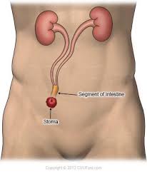 Pin On Health