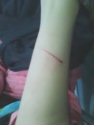 Maybe you would like to learn more about one of these? Shoofi 27 Ø¹Ù„Ù‰ ØªÙˆÙŠØªØ± Terpeleset Kepala Kena Tembok Tangan Berdarah Huhuhub Http T Co Ww3gesjspn