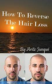 Are you genetically prone to hair loss? How To Reverse The Hair Loss Hair Loss Hair Loss Cure Minoxidil Baldness Cure Baldness Hair Loss Talk Natural Nature Follicle Thought Bald Solution Hairless Spanish Edition Ebook Junque Aritz Loss