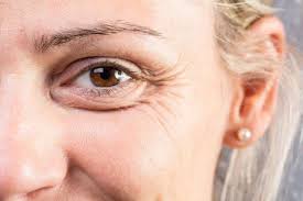 Aufgeschwollenes Gesicht Ursachen Und Tipps Brigitte De