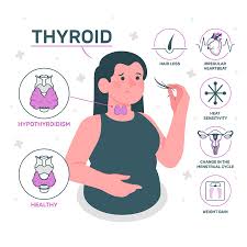 Image result for Thyroid Function Test