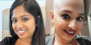 Unlike traditional forms of breast cancer, inflammatory breast cancers do not develop unusual lumps within the affected breast. I Thought I Had Mastitis But It Was Inflammatory Breast Cancer