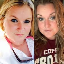 Chest area before and after results